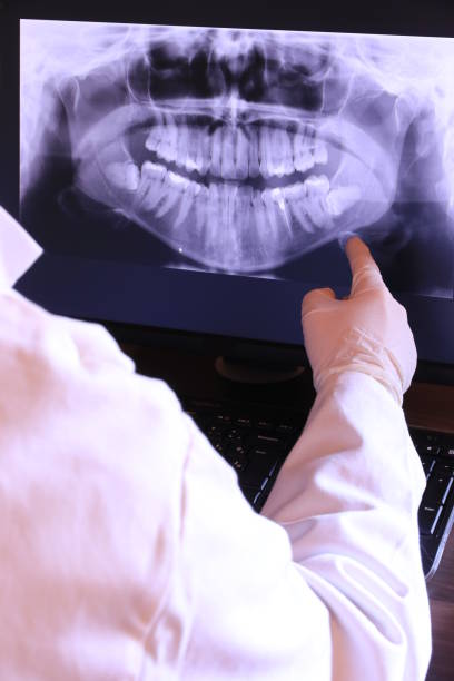Best Emergency Dental Care for Broken or Chipped Teeth in Columbiana, OH